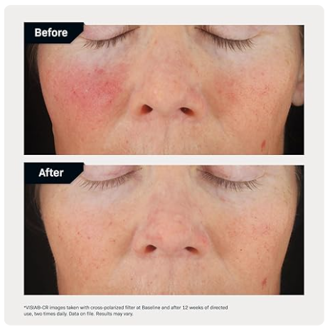 Revision Skincare C+ Correcting Complex